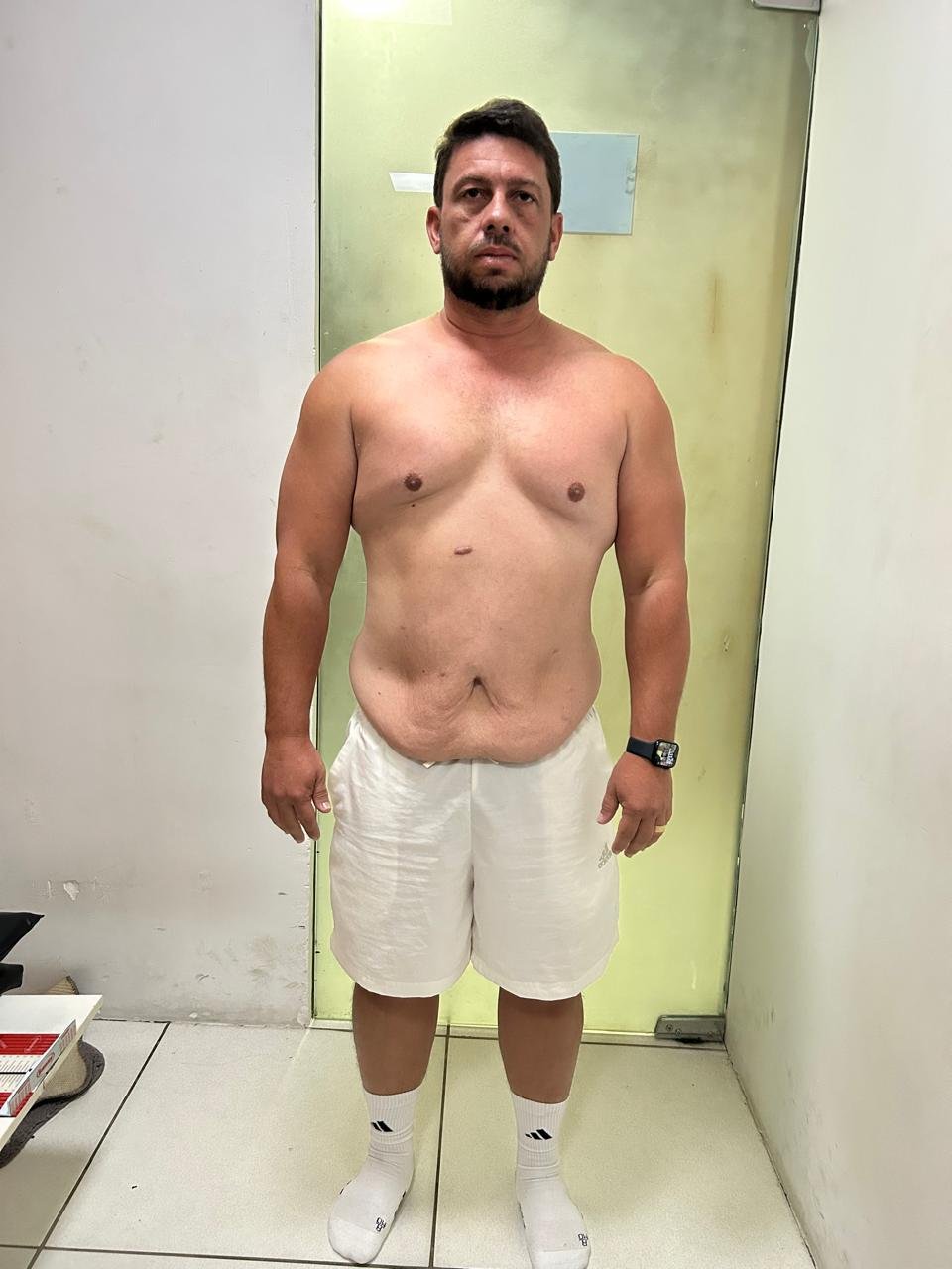 Depois da transformação